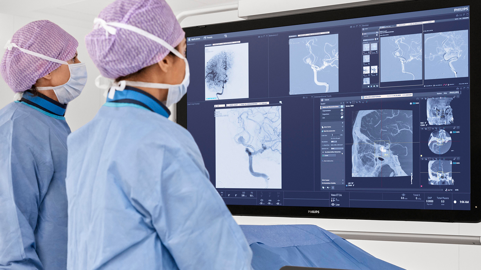 Philips&#39; direct-to-angio stroke pathway: new analysis demonstrates substantial cost savings in addition to improved patient outcomes